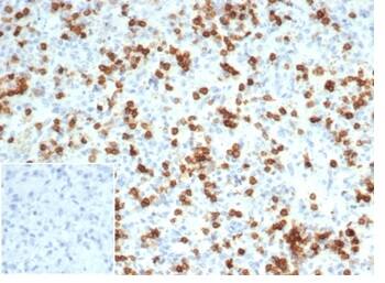 IHC analysis of formalin-fixed, paraffin-embedded human spleen. Staining using CD6 Antibody (C6/7022R) - Azide and BSA Free at 2ug/ml in PBS for 30min RT. Inset: PBS instead of primary antibody; secondary only negative control.
