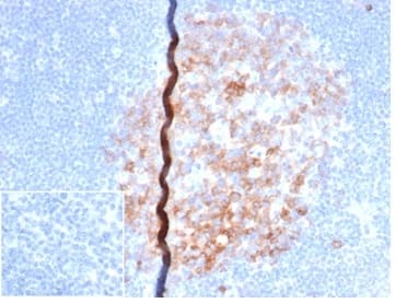 IHC analysis of formalin-fixed, paraffin-embedded human lymph node. Staining of cell surface using B7-2/CD86 Antibody (rC86/6872) - Azide and BSA Free at 2ug/ml in PBS for 30min RT. Inset: PBS instead of primary antibody; secondary only negative control.