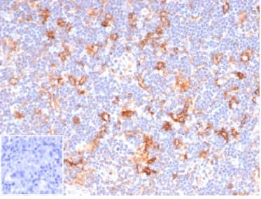 Formalin-fixed, paraffin-embedded human lymph node stained with B7-2/CD86 Antibody (C86/6500R) - Azide and BSA Free. Inset: PBS instead of primary antibody, secondary negative control.