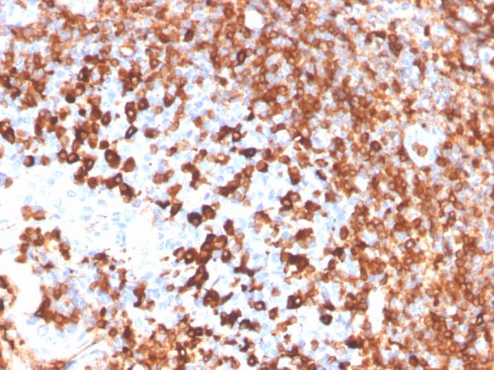 Formalin-fixed, paraffin-embedded human tonsil stained with CD79A Antibody (IGA/3939R) - Azide and BSA Free.