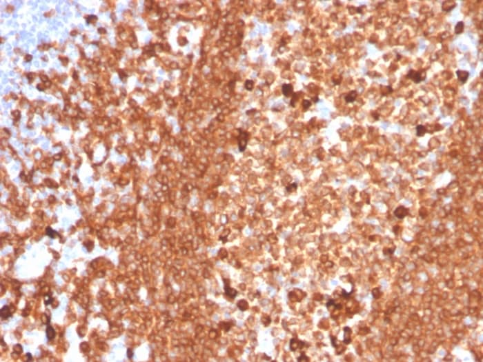 Formalin-fixed, paraffin-embedded human tonsil stained with CD79A Antibody (IGA/3939R) - Azide and BSA Free.