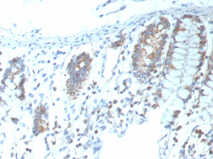 Formalin-fixed, paraffin-embedded human colon stained with CD151 Antibody (CD151/9297R) - Azide and BSA Free. HIER: Tris/EDTA, pH9.0, 45min. 2�C: HRP-polymer, 30min. DAB, 5min.