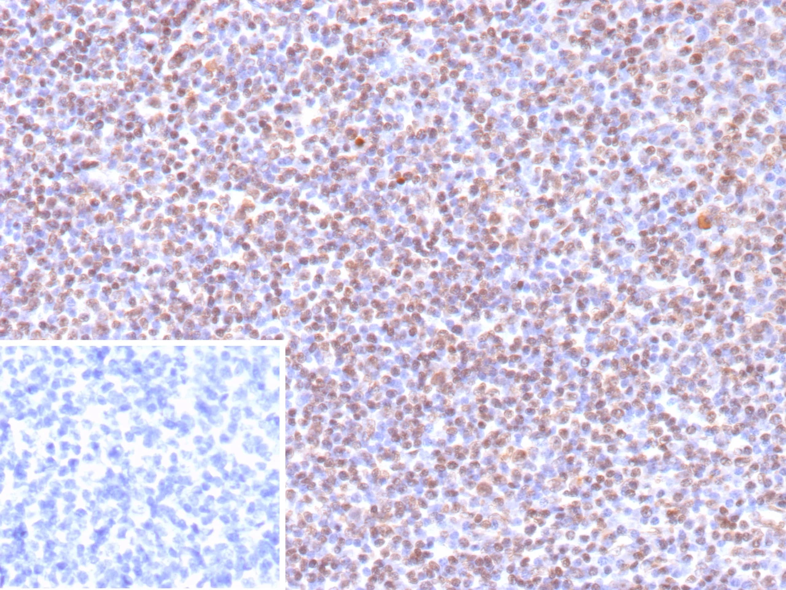 Formalin-fixed, paraffin-embedded human tonsil  stained with Epstein Barr Virus Antibody (EBV/9619R) - Azide and BSA Free. Inset: PBS instead of primary antibody; secondary only negative control. 