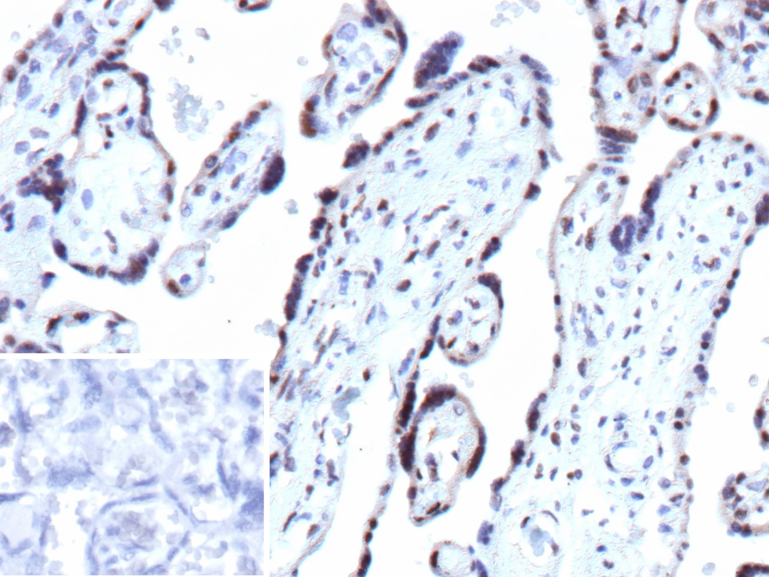 Formalin-fixed, paraffin-embedded human placenta stained with p27/Kip1 Antibody (rCDKN1B/13245) - Azide and BSA Free. Inset: PBS instead of primary antibody; secondary only negative control. 