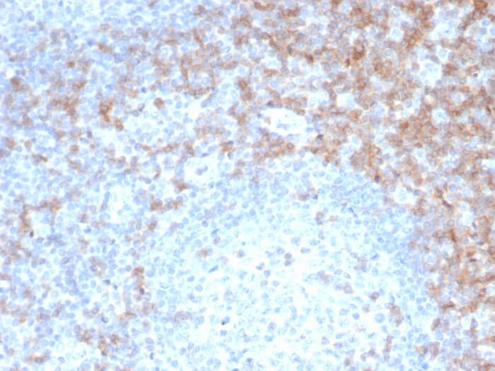 Formalin-fixed, paraffin-embedded human tonsil stained with CD5 Antibody (rC5/6462) - Azide and BSA Free.