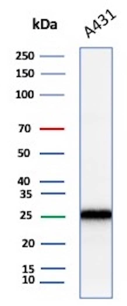 Western blot analysis of A431 lysate using p27/Kip1 Antibody (KIP1/1355R) - Azide and BSA Free.