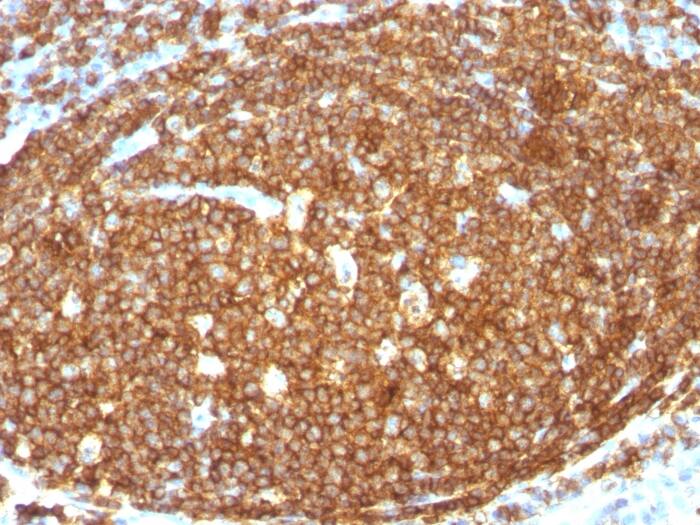 Formalin-fixed, paraffin-embedded human Tonsil stained with CD45RB Antibody (N/A) - Azide and BSA Free.