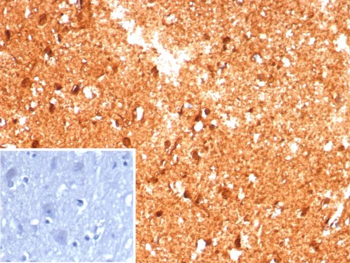 Formalin-fixed, paraffin-embedded human brain stained with Creatine Kinase BB Antibody (CKBB/8609R) - Azide and BSA Free. Inset: PBS instead of primary antibody; secondary only negative control.