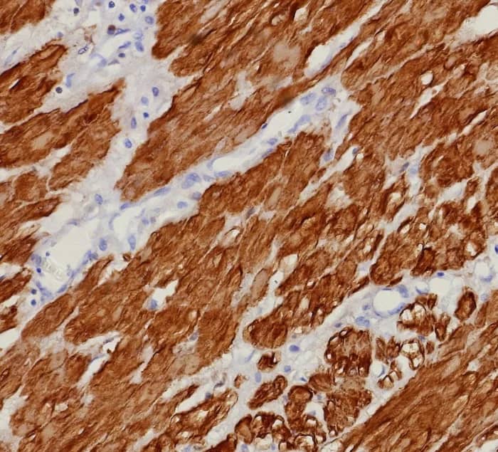 Formalin-fixed, paraffin-embedded human uterus stained with Calponin 1 Antibody (rCNN1/9164) - Azide and BSA Free. HIER: Tris/EDTA, pH9.0, 45min. 2�C: HRP-polymer, 30min. DAB, 5min.