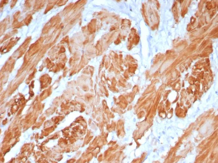 Formalin-fixed, paraffin-embedded human uterus stained with Calponin 1 Antibody (rCNN1/6918) - Azide and BSA Free. HIER: Tris/EDTA, pH9.0, 45min. 2�C: HRP-polymer, 30min. DAB, 5min.