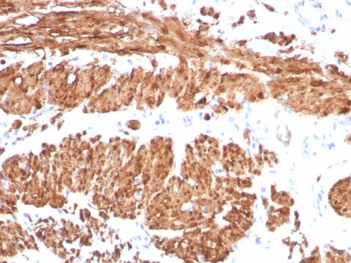 Formalin-fixed, paraffin-embedded human smooth muscle stained with Calponin 1 Antibody (CNN1/8870R) - Azide and BSA Free. HIER: Tris/EDTA, pH9.0, 45min. 2�C: HRP-polymer, 30min. DAB, 5min.