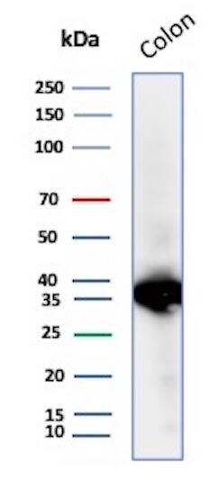 Western Blot Analysis of Colon tissue lysate using Calponin 1 Antibody (CNN1/8870R) - Azide and BSA Free.