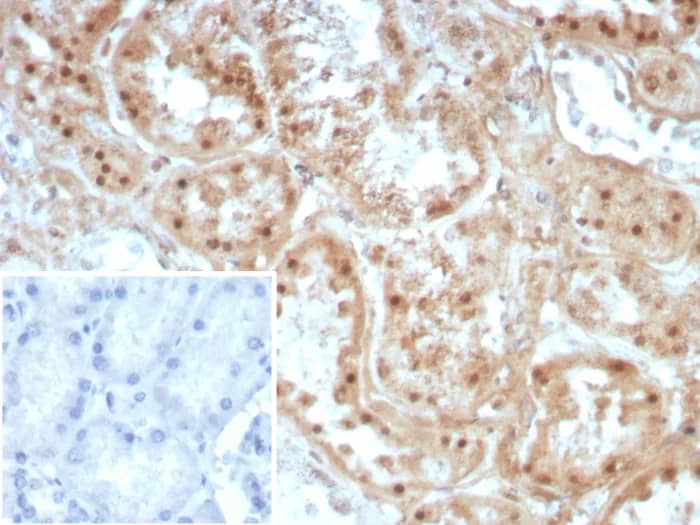 Formalin-fixed, paraffin-embedded human kidney stained with Collagen II Antibody (COL2A1/8810R) - Azide and BSA Free. Inset: PBS instead of primary antibody; secondary only negative control.