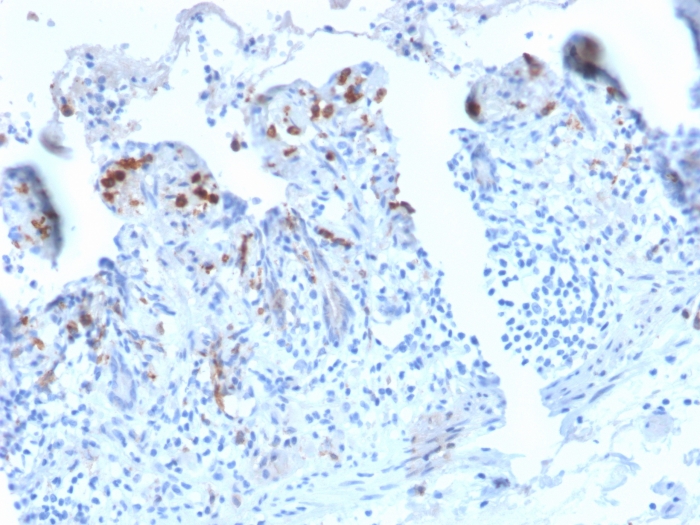 Formalin-fixed, paraffin-embedded human Small Intestine stained with DC-SIGN/CD209 Antibody (C209/2749R) - Azide and BSA Free.