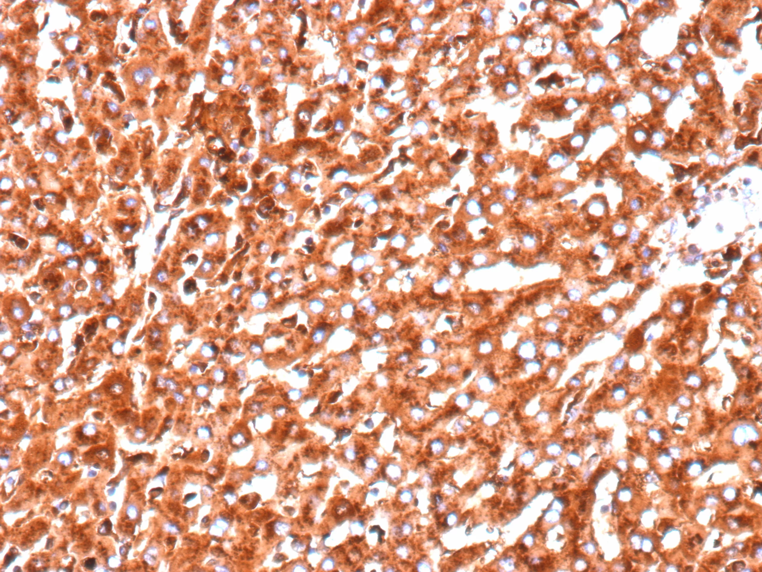 Formalin-fixed, paraffin-embedded human pancreas stained with Cathepsin D Antibody (CTSD/9613R) - Azide and BSA Free. HIER: Tris/EDTA, pH9.0, 45min. 2�: HRP-polymer, 30min. DAB, 5min.