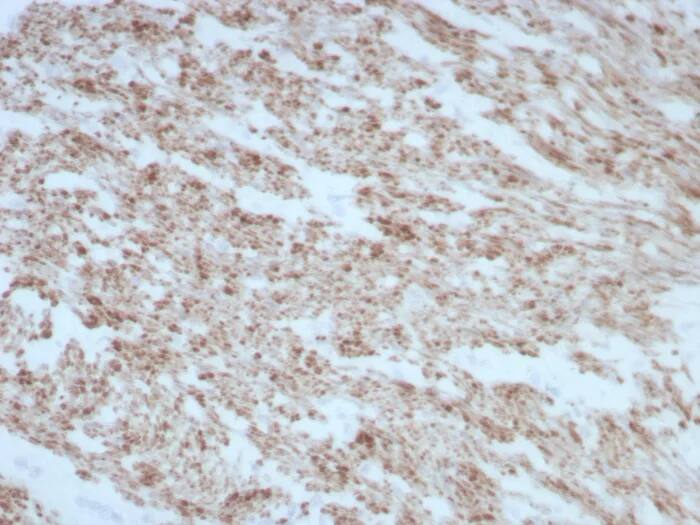 Formalin-fixed, paraffin-embedded human smooth muscle stained with Desmin Antibody (rDES/8846) - Azide and BSA Free. HIER: Tris/EDTA, pH9.0, 45min. 2�C: HRP-polymer, 30min. DAB, 5min.