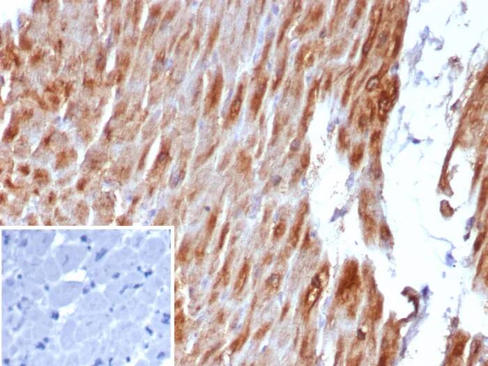 Formalin-fixed, paraffin-embedded human heart muscle stained with Desmin Antibody (DES/8610R) - Azide and BSA Free. Inset: PBS instead of primary antibody; secondary only negative control.