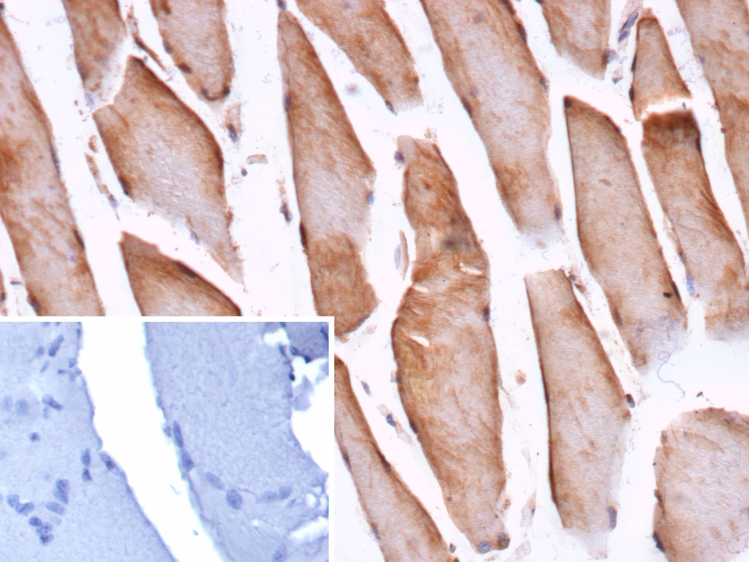 Formalin-fixed, paraffin-embedded human skeletal muscle stained with Cofilin 2 Antibody (CFL2/9963) - Azide and BSA Free. Inset: PBS instead of primary antibody; secondary only negative control.