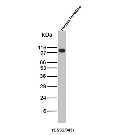 Western blot analysis of Human Intestine lysate using Desmocollin-2 Antibody (rDSC2/3437) - Azide and BSA Free.