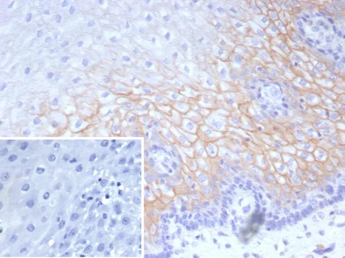 Formalin-fixed, paraffin-embedded human esophagus stained with Desmocollin-2 Antibody (DSC2/9165R) - Azide and BSA Free. Inset: PBS instead of primary antibody; secondary only negative control.