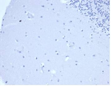 IHC analysis of formalin-fixed, paraffin-embedded human brain. Negative tissue control using Prolactin Antibody (rPRL/4907) - Azide and BSA Free at 2ug/ml in PBS for 30min RT. HIER: Tris/EDTA, pH9.0, 45min. 2�C: HRP-polymer, 30min. DAB, 5min.