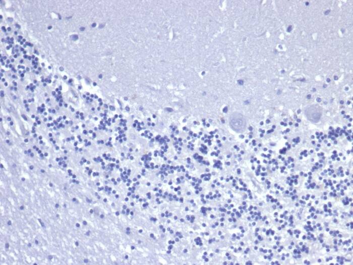 IHC analysis of formalin-fixed, paraffin-embedded human brain. Negative tissue control using Cytokeratin 8 Antibody (rKRT8/6471) - Azide and BSA Free at 2ug/ml in PBS for 30min RT. HIER: Tris/EDTA, pH9.0, 45min. 2�C: HRP-polymer, 30min. DAB, 5min.