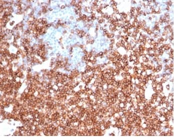 IHC analysis of formalin-fixed, paraffin-embedded human colon. Strong membrane staining using CD43/Sialophorin Antibody (rSPN/6563) - Azide and BSA Free at 2ug/ml in PBS for 30min RT. HIER: Tris/EDTA, pH9.0, 45min. 2�C: HRP-polymer, 30min. DAB, 5min.