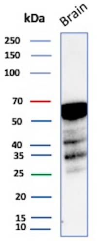 Western Blot Analysis of Human Brain tissue lysate using Aldehyde Dehydrogenase 1-A1/ALDH1A1 Antibody (rALDH1A1/7285) - Azide and BSA Free.