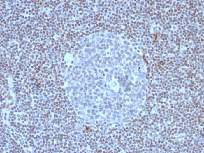 Formalin-fixed, paraffin-embedded human lymph node stained with FLI1 Antibody (FLI1/8318R) - Azide and BSA Free. HIER: Tris/EDTA, pH9.0, 45min. 2�C: HRP-polymer, 30min. DAB, 5min.