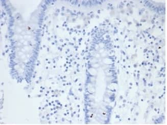 IHC analysis of formalin-fixed, paraffin-embedded human colon. Negative tissue control using Alkaline Phosphatase/ALPP/ALPI Antibody (rALP/870) - Azide and BSA Free at 2ug/ml in PBS for 30min RT. HIER: Tris/EDTA, pH9.0, 45min. 2 °: HRP-polymer, 30min. DAB, 5min.