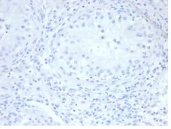 IHC analysis of formalin-fixed, paraffin-embedded human testis. Negative tissue control using Alkaline Phosphatase/ALPP/ALPI Antibody (rALP/870) - Azide and BSA Free at 2ug/ml in PBS for 30min RT. HIER: Tris/EDTA, pH9.0, 45min. 2 °: HRP-polymer, 30min. DAB, 5min.