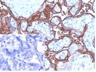 IHC analysis of formalin-fixed, paraffin-embedded human placenta stained using Alkaline Phosphatase/ALPP/ALPI Antibody (ALPP/4109) - Azide and BSA Free at 2ug/ml in PBS for 30min RT. Inset: PBS used instead of the primary antibody as the negative control.