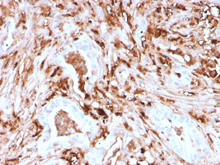 Formalin-fixed, paraffin-embedded human Pancreas stained with Ferritin Light Chain Antibody (rFTL/1388) - Azide and BSA Free.