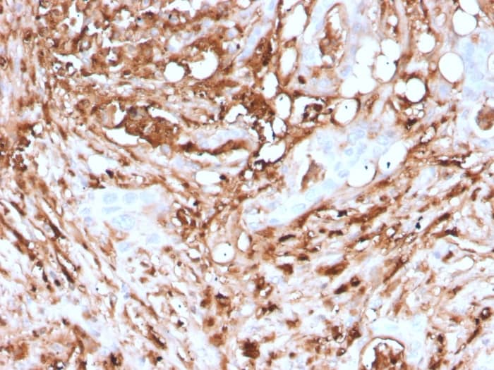 Formalin-fixed, paraffin-embedded human Pancreas stained with Ferritin Light Chain Antibody (rFTL/1388) - Azide and BSA Free.