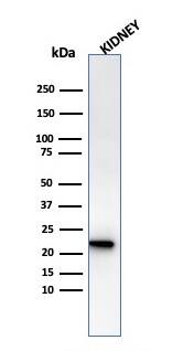 Western Blot Analysis of human Kidney tissue lysate using Ferritin Light Chain Antibody (rFTL/1386) - Azide and BSA Free.