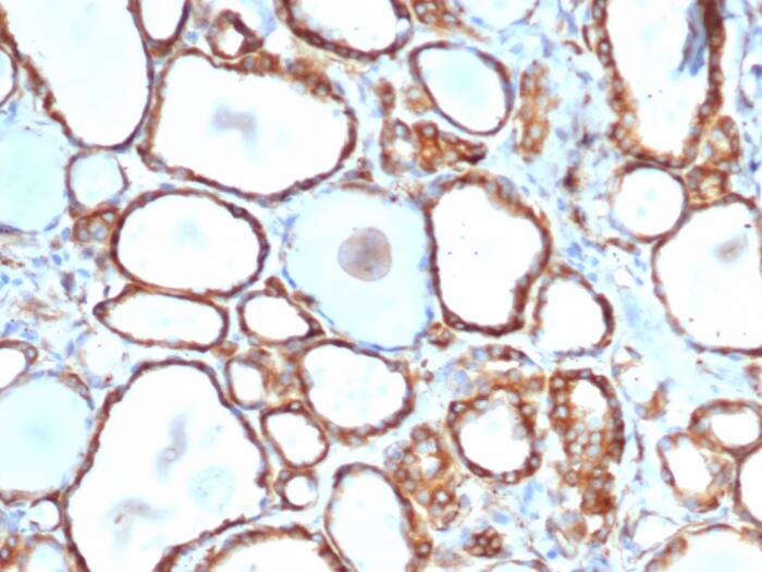 Formalin-fixed, paraffin-embedded human thyroid stained with HSP27 Antibody (rHSPB1/6489) - Azide and BSA Free.
