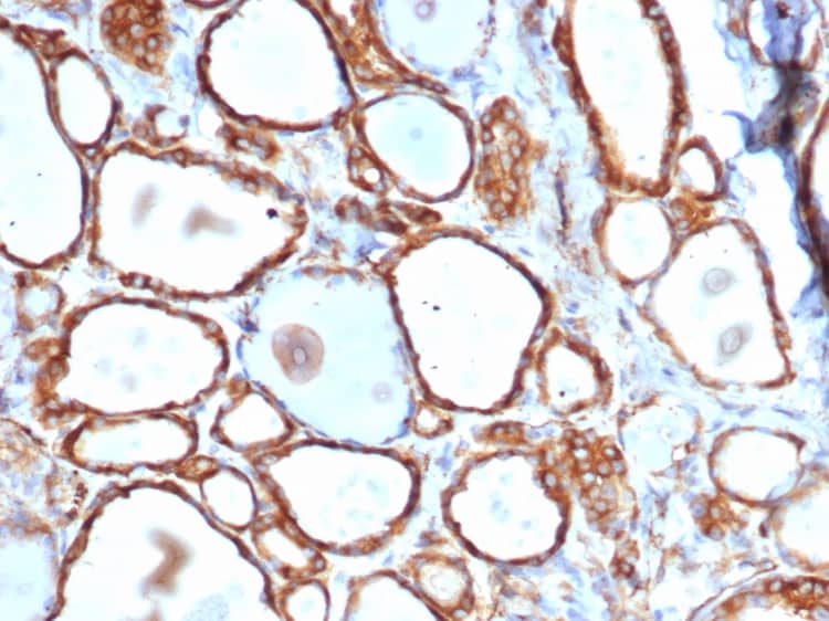 Formalin-fixed, paraffin-embedded human thyroid stained with HSP27 Antibody (HSPB1/6490R) - Azide and BSA Free.