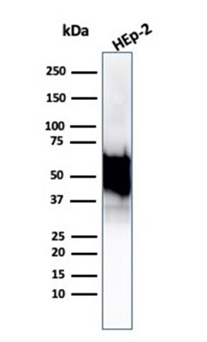 Western blot analysis of Hep2 cell lysate using HSP60 Antibody (rHSPD1/6495) - Azide and BSA Free.