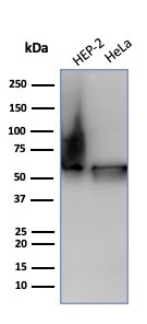 Western blot analysis of Hep2 and HeLa cell lysate using HSP60 Antibody (HSPD1/6498R) - Azide and BSA Free.