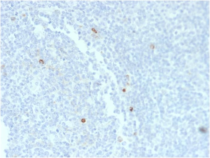 Formalin-fixed, paraffin-embedded human Tonsil stained with IgM Antibody (rIM373) - Azide and BSA Free.