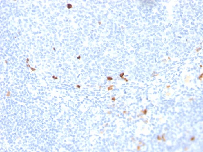 Formalin-fixed, paraffin-embedded human tonsil stained with IgM Antibody (rIGHM/1623) - Azide and BSA Free.