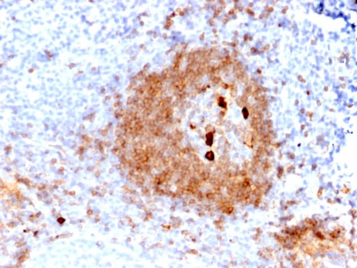Formalin-fixed, paraffin-embedded human Tonsil stained with IgM Antibody (rIGHM/2558) - Azide and BSA Free.