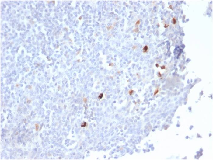 Formalin-fixed, paraffin-embedded human Tonsil stained with IgM Antibody (IGHM/2559R) - Azide and BSA Free.