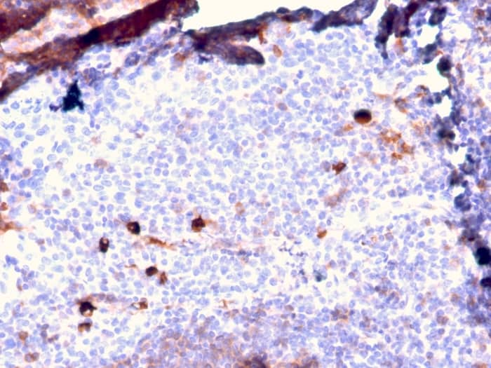 Formalin-fixed, paraffin-embedded human Tonsil stained with IgM Antibody (IGHM/2557R) - Azide and BSA Free.