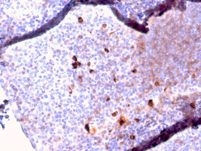 Formalin-fixed, paraffin-embedded human Tonsil stained with IgM Antibody (IGHM/2557R) - Azide and BSA Free.