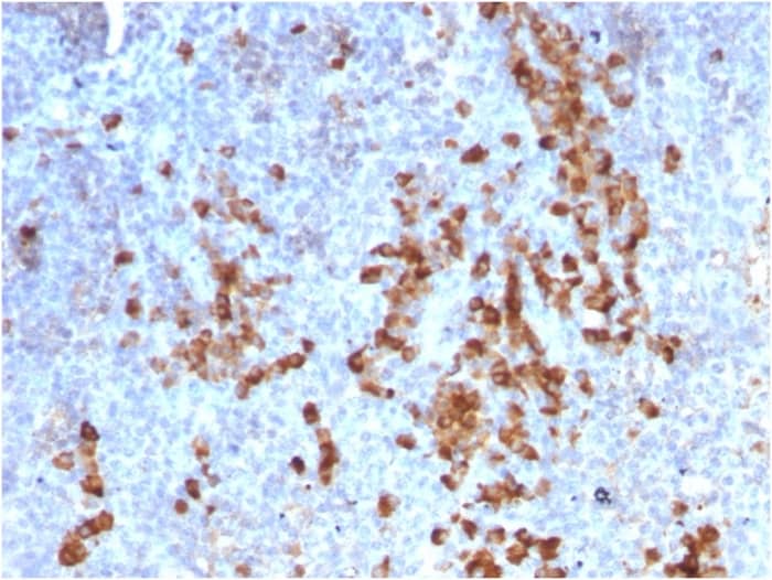 Formalin-fixed, paraffin-embedded human Tonsil stained with Kappa Light Chain Antibody (rKLC709) - Azide and BSA Free.