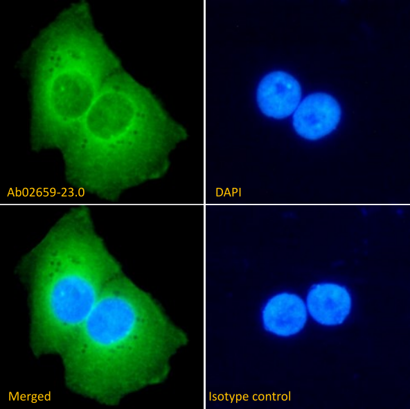 Analysis of paraformaldehyde-fixed A431 cells on coverslips stained with the chimeric rabbit IgG version of MT201 (NBP3-45124) (1:100 dilution) for 1h followed by Alexa Fluor� 488 secondary antibody (1:1000 dilution), showing cytoplasmic and membrane staining. The nuclear stain is DAPI (blue). Panels show, from left-right, top-bottom, NBP3-45124, DAPI, merged channels and an isotype control. The isotype control was an unknown specificity antibody followed by staining with Alexa Fluor� 488 secondary antibody.