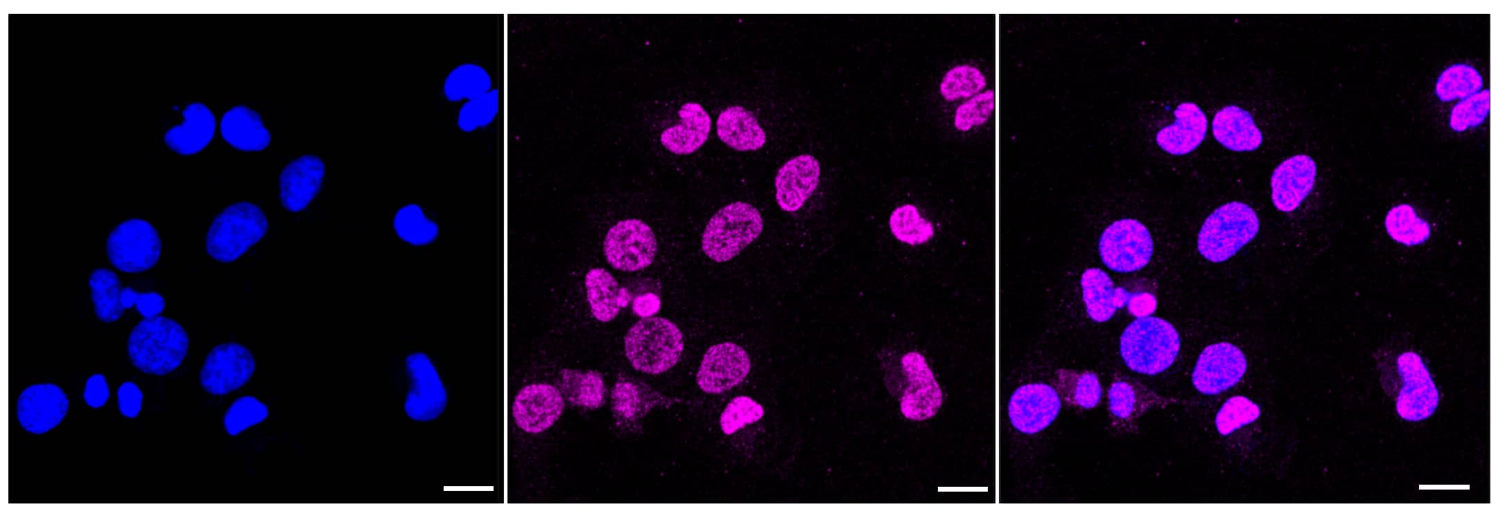 Immunocytochemical staining of HT-1080 cells with PrPC antibody (1:1,000) . Nuclei were stained blue with DAPI; PrPC was stained magenta with Alexa Fluor(R) 647. Images were taken using Leica stellaris 5. Protein abundance based on laser Intensity and smart gain: Medium. Scale bar, 20 um.
