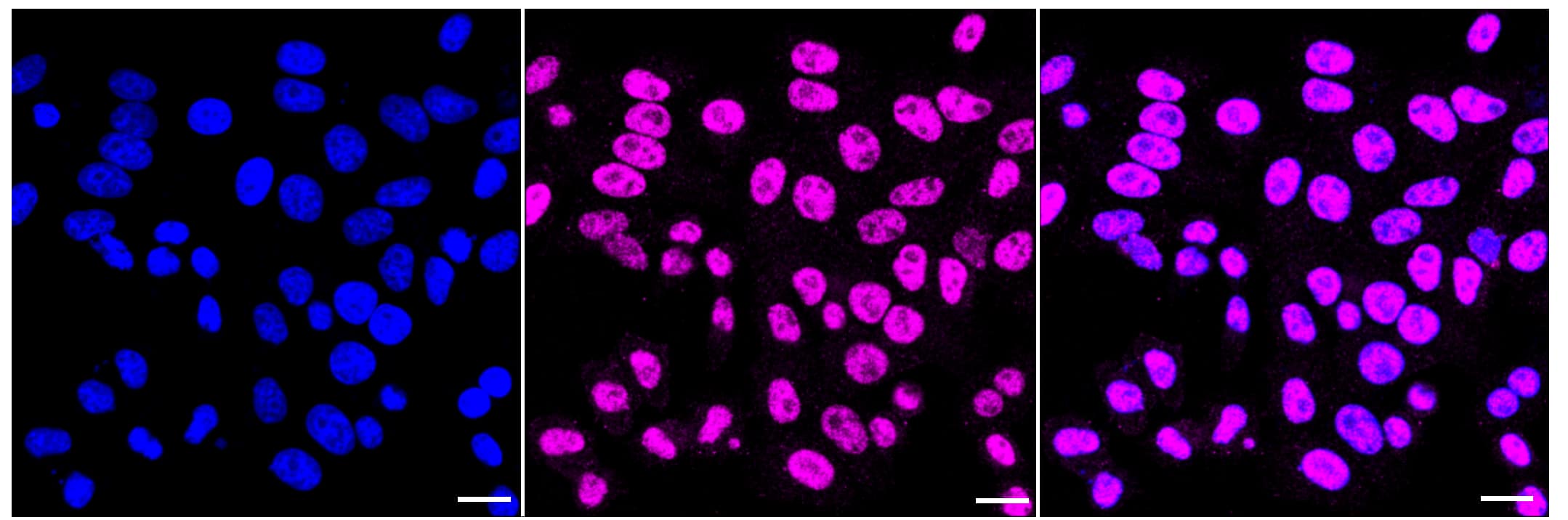 Immunocytochemical staining of HepG2 cells with RNF20 antibody (1:1,000). Nuclei were stained blue with DAPI; RNF20 was stained magenta with Alexa Fluor(R) 647. Images were taken using Leica stellaris 5. Protein abundance based on laser Intensity and smart gain: Medium. Scale bar, 20 um.