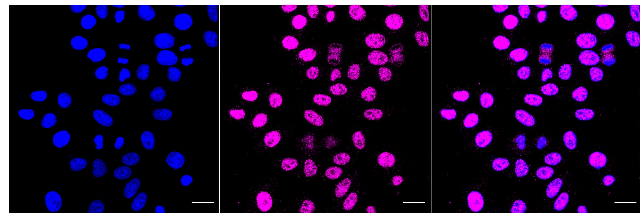 Immunocytochemical staining of HepG2 cells with PLA2G2A antibody (1:1,000). Nuclei were stained blue with DAPI; PLA2G2A was stained magenta with Alexa Fluor(R) 647. Images were taken using Leica stellaris 5. Protein abundance based on laser Intensity and smart gain: Medium. Scale bar, 20 um.